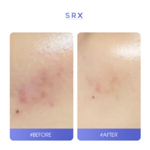 Repair ampoule SRX review